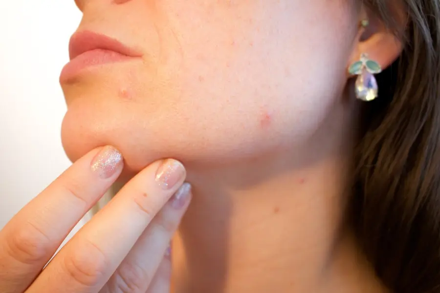 Le malattie della pelle più pericolose per cui è necessaria una visita dermatologica